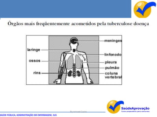By Ismael Costa
SAÚDE PÚBLICA, ADMINISTRAÇÃO EM ENFERMAGEM, SUS
 