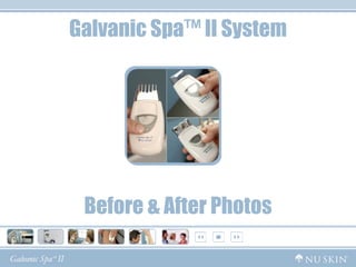 Galvanic Spa™ II System




 Before & After Photos