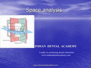 Space analysis
INDIAN DENTAL ACADEMY
Leader in continuing dental education
www.indiandentalacademy.com
www.indiandentalacademy.com
 