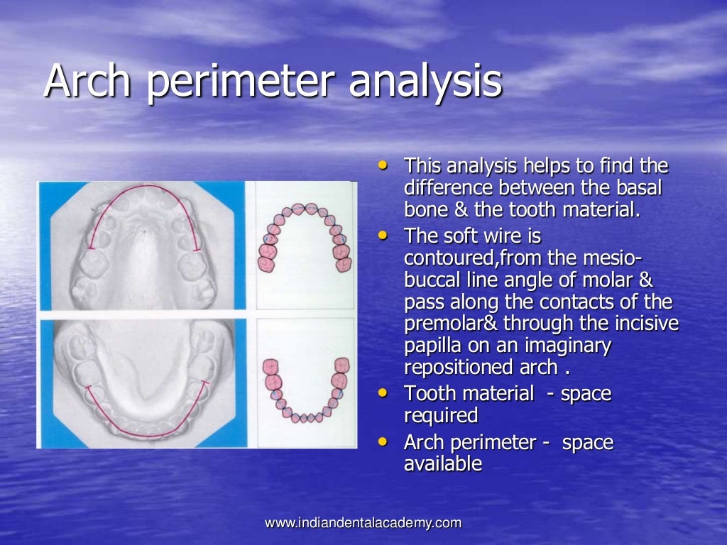 Space analysis /certified fixed orthodontic courses by Indian dental
