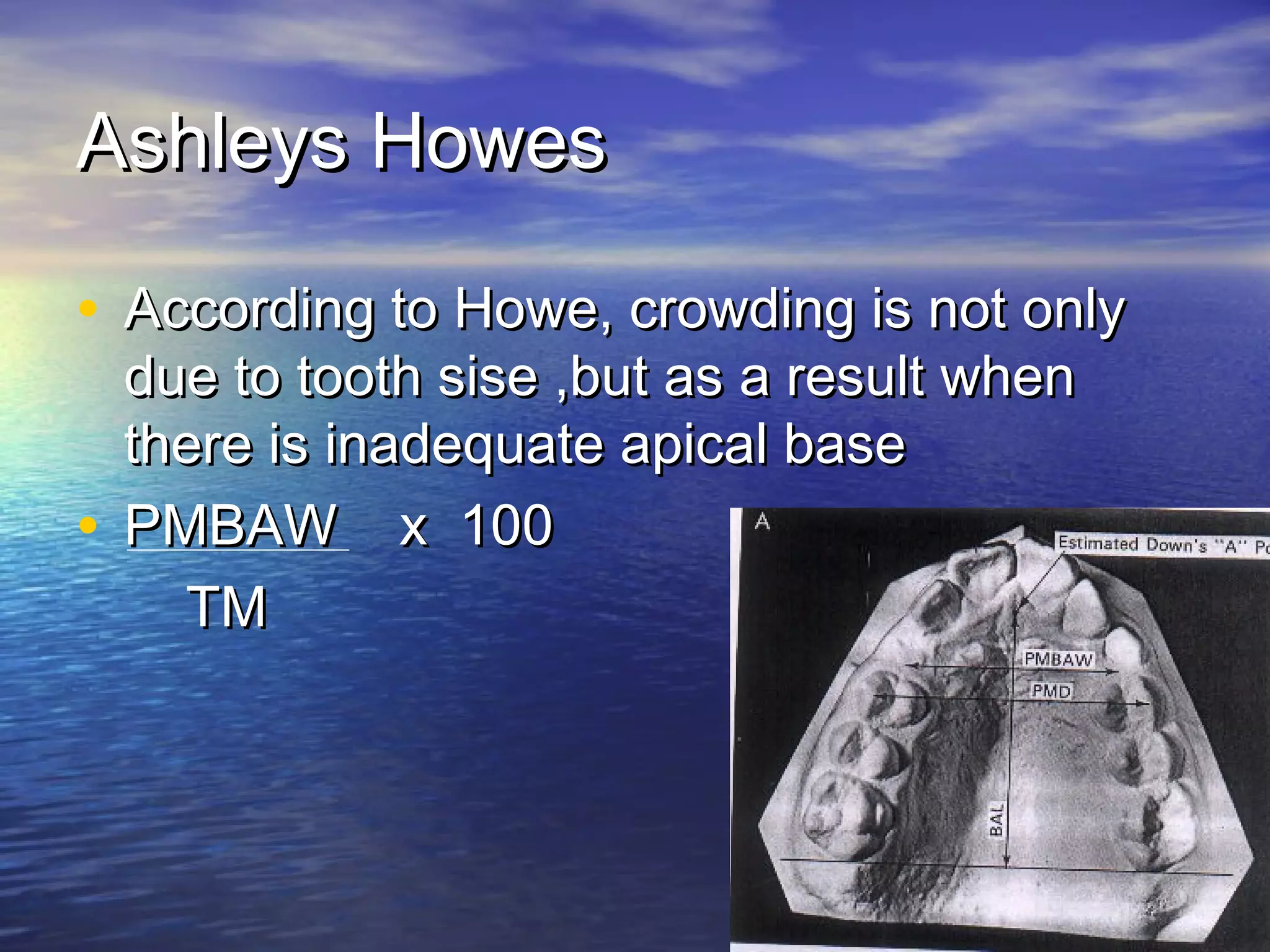Ashleys HowesAshleys Howes
• According to Howe, crowding is not onlyAccording to Howe, crowding is not only
due to tooth sise ,but as a result whendue to tooth sise ,but as a result when
there is inadequate apical basethere is inadequate apical base
• PMBAW x 100PMBAW x 100
TMTM
 