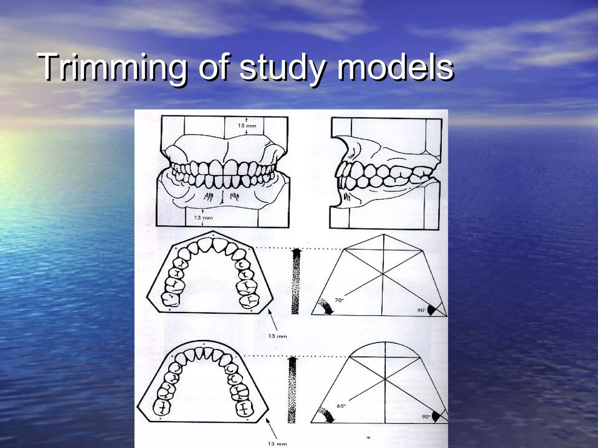 Trimming of study modelsTrimming of study models
 