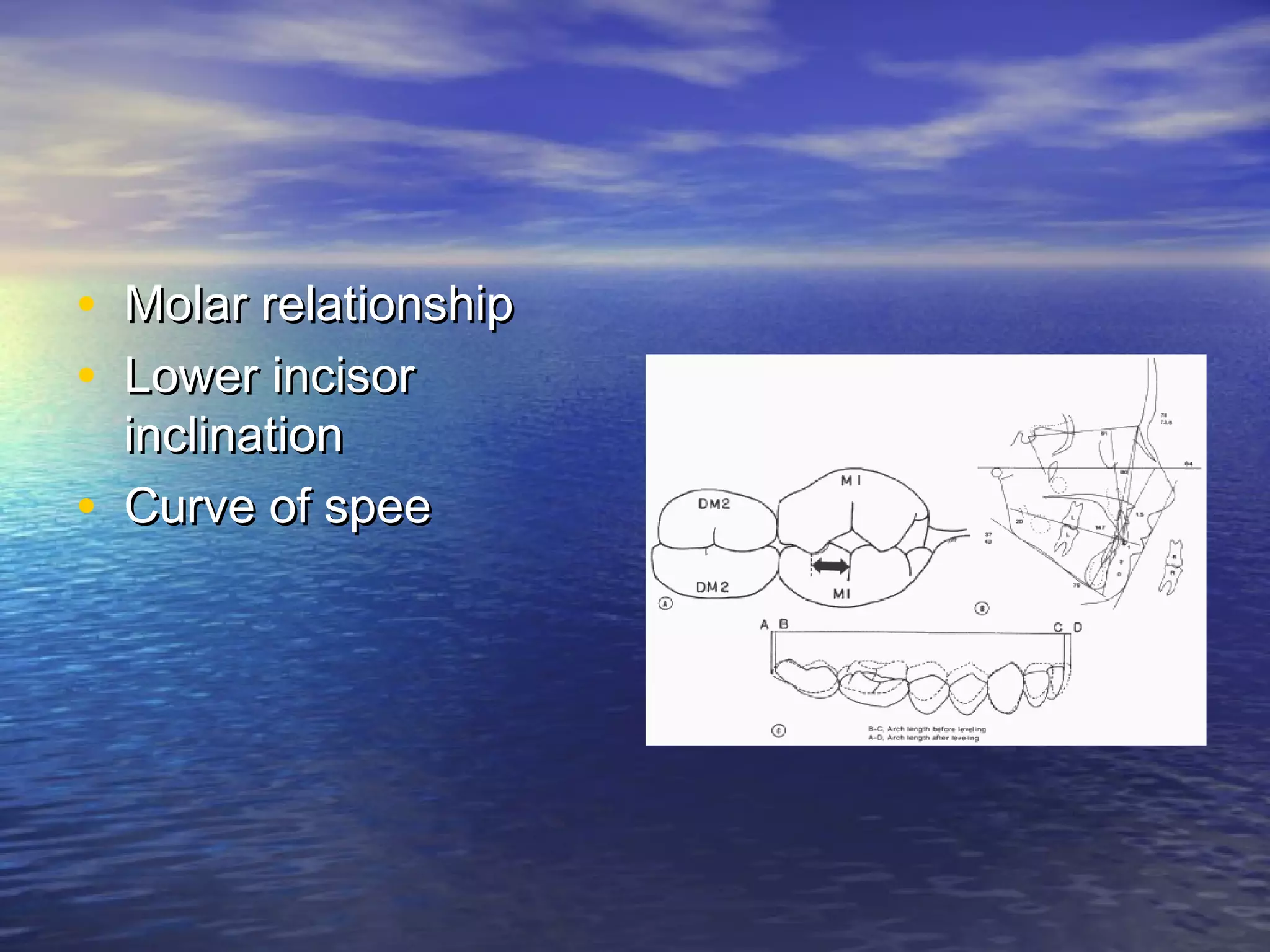 • Molar relationshipMolar relationship
• Lower incisorLower incisor
inclinationinclination
• Curve of speeCurve of spee
 