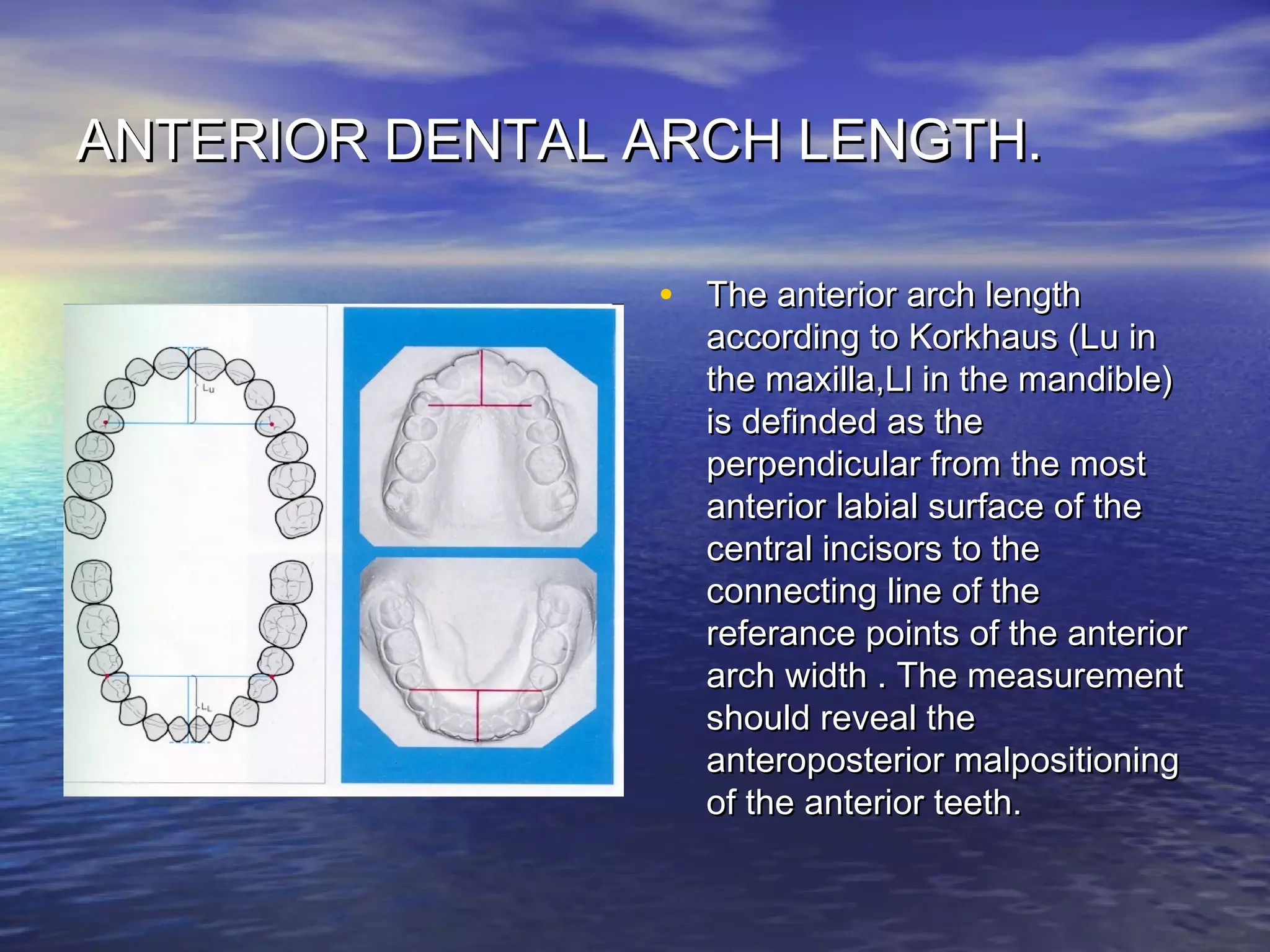 ANTERIOR DENTAL ARCH LENGTH.ANTERIOR DENTAL ARCH LENGTH.
• The anterior arch lengthThe anterior arch length
according to Korkhaus (Lu inaccording to Korkhaus (Lu in
the maxilla,Ll in the mandible)the maxilla,Ll in the mandible)
is definded as theis definded as the
perpendicular from the mostperpendicular from the most
anterior labial surface of theanterior labial surface of the
central incisors to thecentral incisors to the
connecting line of theconnecting line of the
referance points of the anteriorreferance points of the anterior
arch width . The measurementarch width . The measurement
should reveal theshould reveal the
anteroposterior malpositioninganteroposterior malpositioning
of the anterior teeth.of the anterior teeth.
 