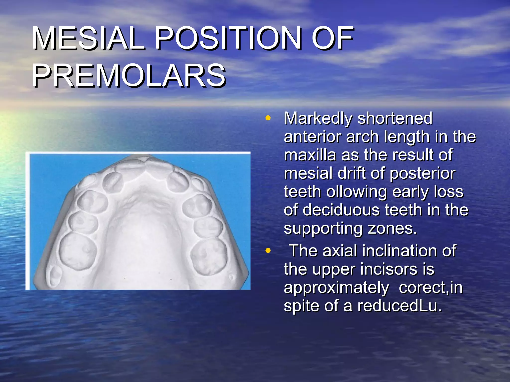 MESIAL POSITION OFMESIAL POSITION OF
PREMOLARSPREMOLARS
• Markedly shortenedMarkedly shortened
anterior arch length in theanterior arch length in the
maxilla as the result ofmaxilla as the result of
mesial drift of posteriormesial drift of posterior
teeth ollowing early lossteeth ollowing early loss
of deciduous teeth in theof deciduous teeth in the
supporting zones.supporting zones.
• The axial inclination ofThe axial inclination of
the upper incisors isthe upper incisors is
approximately corect,inapproximately corect,in
spite of a reducedLu.spite of a reducedLu.
 