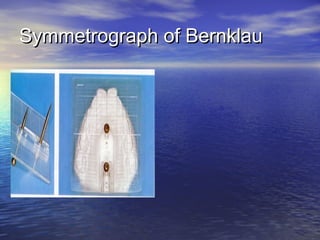 Symmetrograph of BernklauSymmetrograph of Bernklau
 