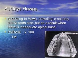 Ashleys HowesAshleys Howes
• According to Howe, crowding is not onlyAccording to Howe, crowding is not only
due to tooth sise ,but as a result whendue to tooth sise ,but as a result when
there is inadequate apical basethere is inadequate apical base
• PMBAW x 100PMBAW x 100
TMTM
 
