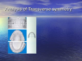 Analysis of Transverse symmetryAnalysis of Transverse symmetry
 
