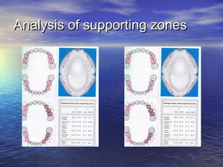 Analysis of supporting zonesAnalysis of supporting zones
 