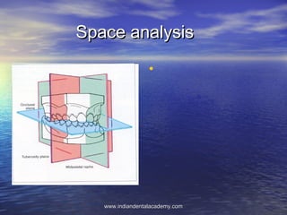 Space analysisSpace analysis
•
www.indiandentalacademy.comwww.indiandentalacademy.com
 