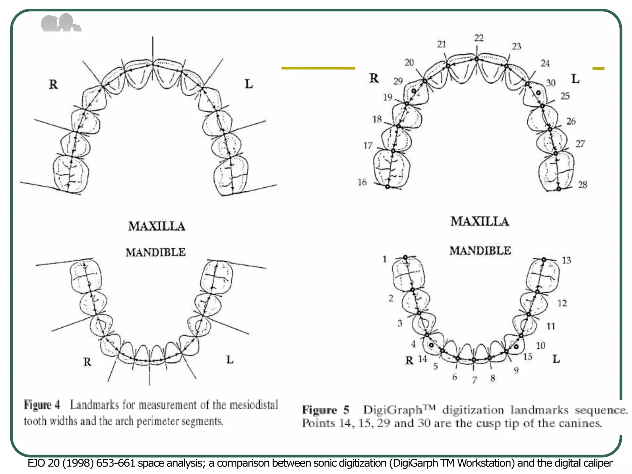 EJO 20 (1998) 653-661 space analysis; a comparison between sonic digitization (DigiGarph TM Workstation) and the digital caliper
 
