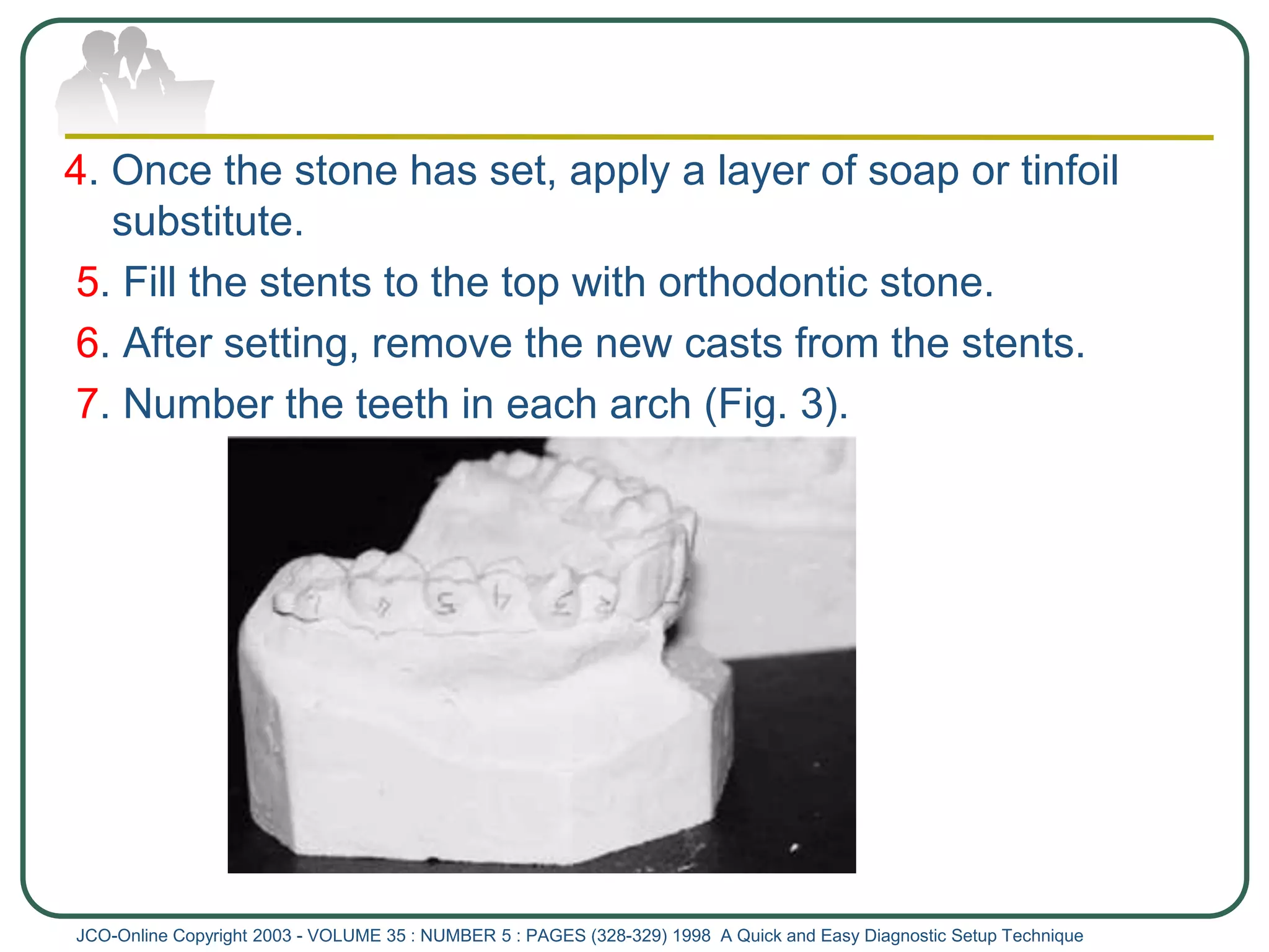 4. Once the stone has set, apply a layer of soap or tinfoil
substitute.
5. Fill the stents to the top with orthodontic stone.
6. After setting, remove the new casts from the stents.
7. Number the teeth in each arch (Fig. 3).
JCO-Online Copyright 2003 - VOLUME 35 : NUMBER 5 : PAGES (328-329) 1998 A Quick and Easy Diagnostic Setup Technique
 