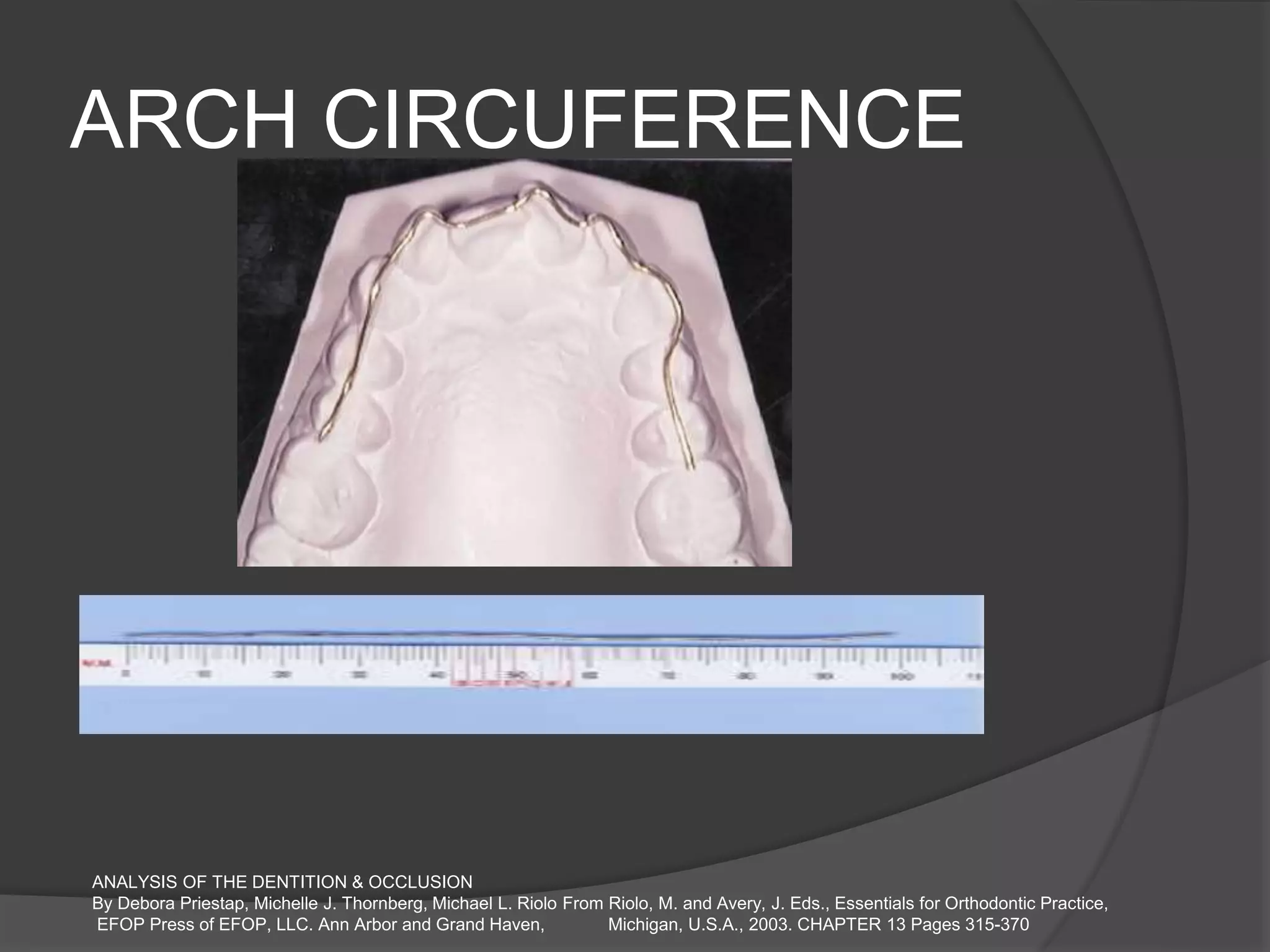 ARCH CIRCUFERENCE
ANALYSIS OF THE DENTITION & OCCLUSION
By Debora Priestap, Michelle J. Thornberg, Michael L. Riolo From Riolo, M. and Avery, J. Eds., Essentials for Orthodontic Practice,
EFOP Press of EFOP, LLC. Ann Arbor and Grand Haven, Michigan, U.S.A., 2003. CHAPTER 13 Pages 315-370
 