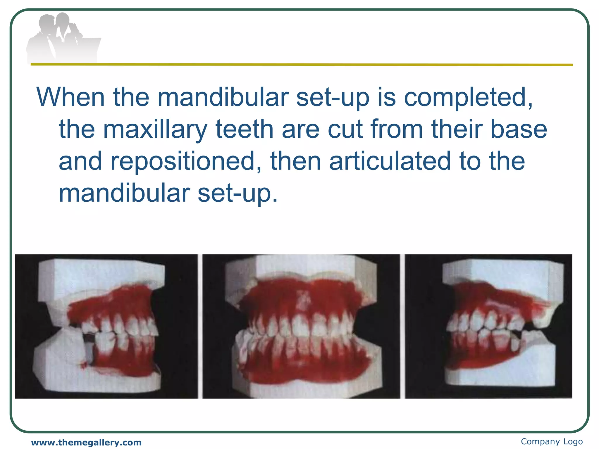 When the mandibular set-up is completed,
the maxillary teeth are cut from their base
and repositioned, then articulated to the
mandibular set-up.
Company Logo
www.themegallery.com
 