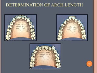 Space Analysis in orthodontics and pedodontics.pptx