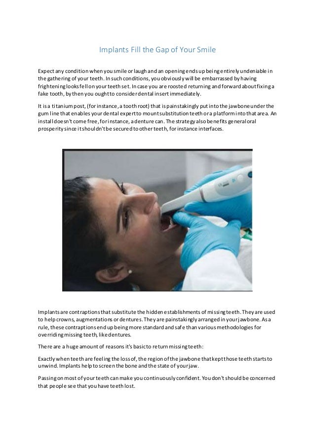 Space between teeth toothsi