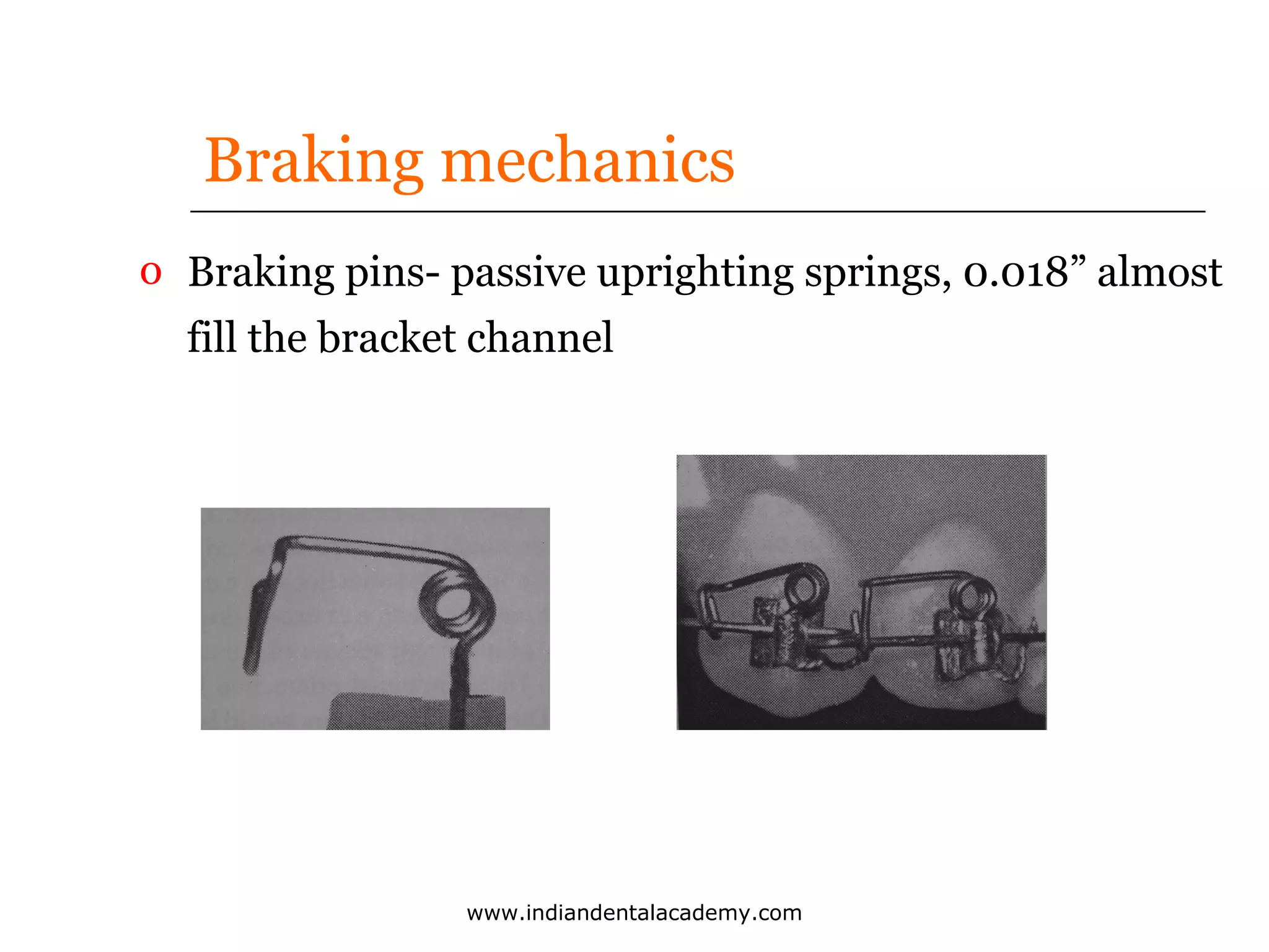 Braking mechanics
o Braking pins- passive uprighting springs, 0.018” almost
fill the bracket channel

www.indiandentalacademy.com

 