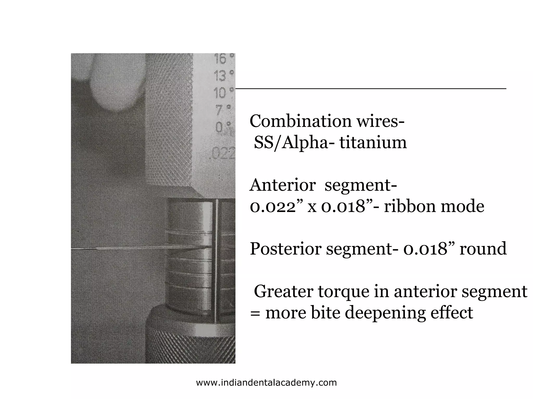 Combination wiresSS/Alpha- titanium
Anterior segment0.022” x 0.018”- ribbon mode
Posterior segment- 0.018” round
Greater torque in anterior segment
= more bite deepening effect

www.indiandentalacademy.com

 