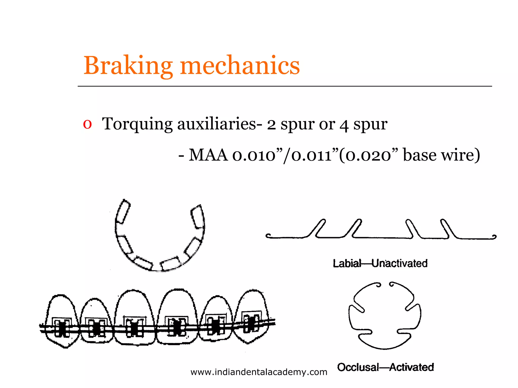 Braking mechanics
o Torquing auxiliaries- 2 spur or 4 spur
- MAA 0.010”/0.011”(0.020” base wire)

www.indiandentalacademy.com

 