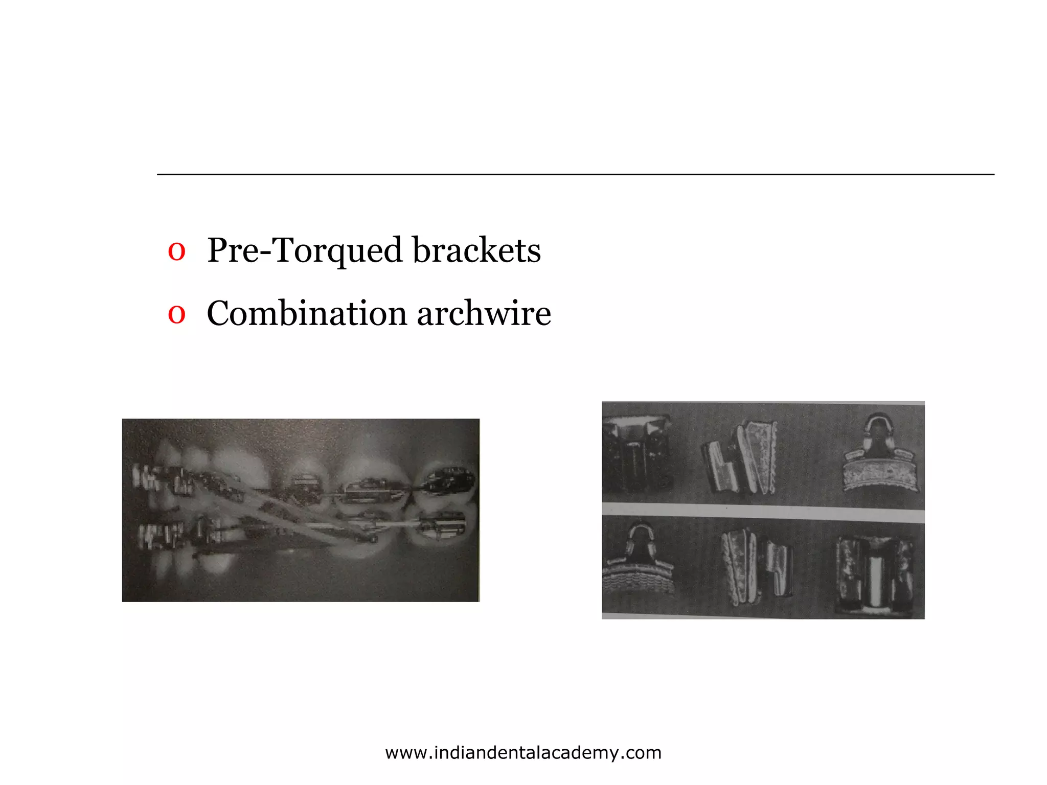 o Pre-Torqued brackets
o Combination archwire

www.indiandentalacademy.com

 