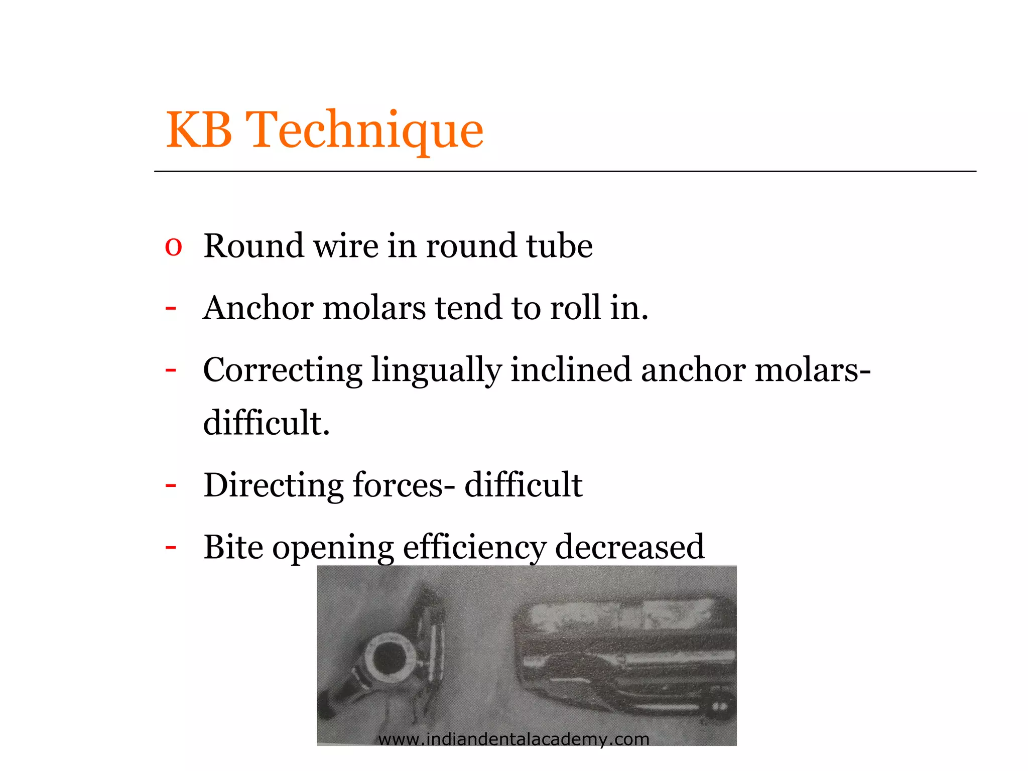 KB Technique
o Round wire in round tube
- Anchor molars tend to roll in.
- Correcting lingually inclined anchor molarsdifficult.
- Directing forces- difficult
- Bite opening efficiency decreased

www.indiandentalacademy.com

 