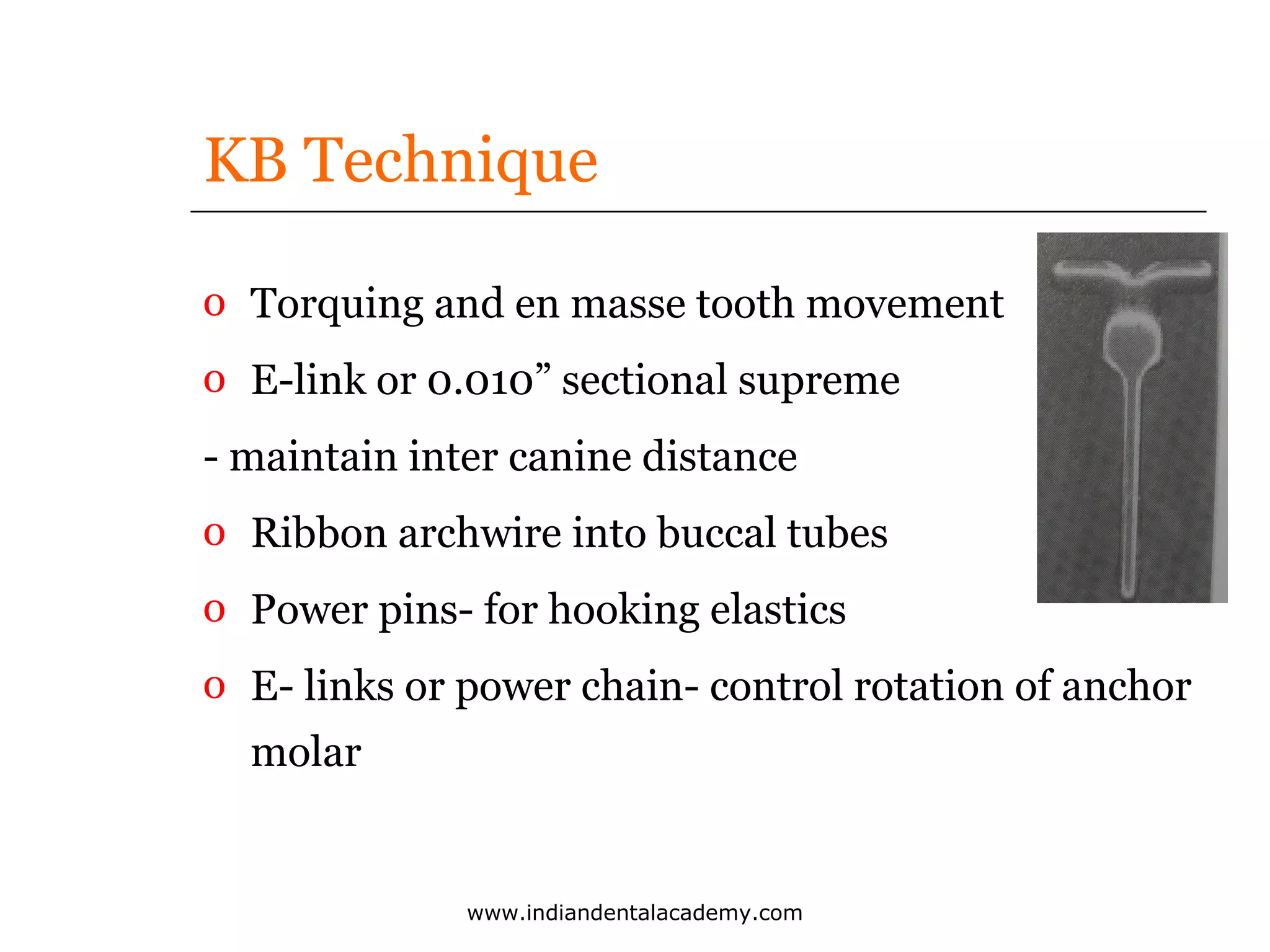 KB Technique
o Torquing and en masse tooth movement
o E-link or 0.010” sectional supreme
- maintain inter canine distance
o Ribbon archwire into buccal tubes
o Power pins- for hooking elastics
o E- links or power chain- control rotation of anchor
molar

www.indiandentalacademy.com

 