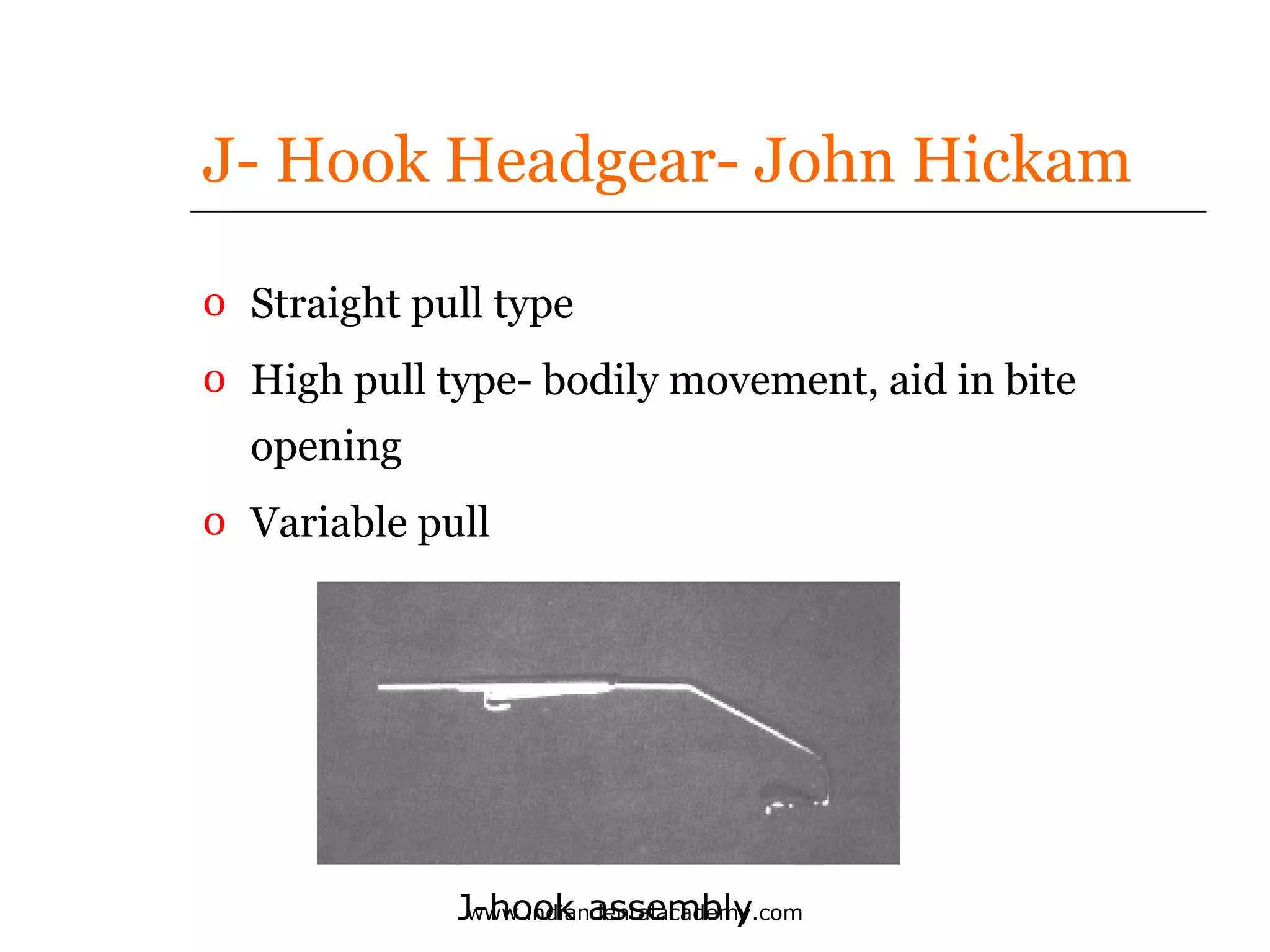 J- Hook Headgear- John Hickam
o Straight pull type
o High pull type- bodily movement, aid in bite
opening
o Variable pull

J-hook assembly
www.indiandentalacademy.com

 