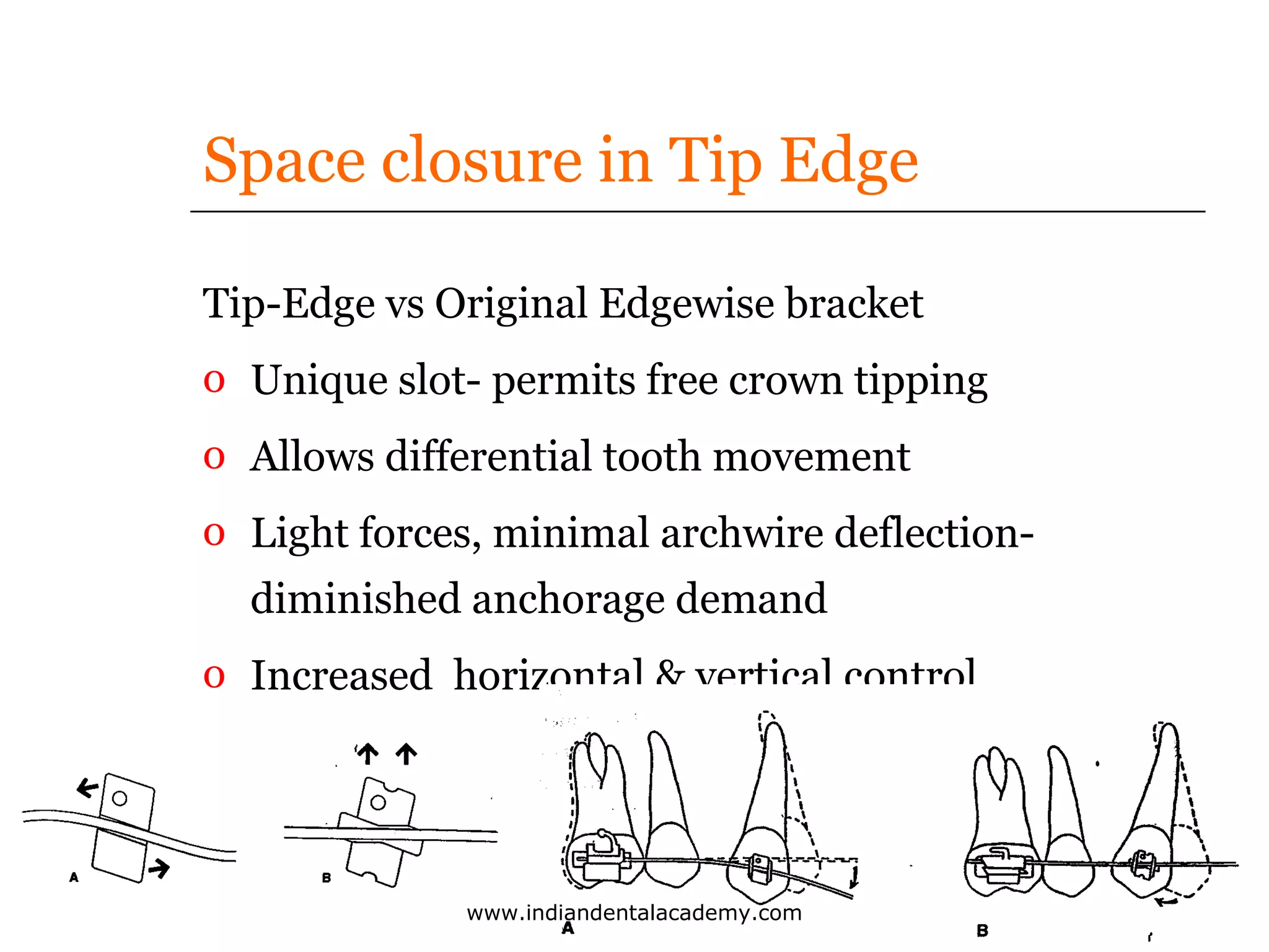 Space closure in Tip Edge
Tip-Edge vs Original Edgewise bracket
o Unique slot- permits free crown tipping
o Allows differential tooth movement
o Light forces, minimal archwire deflectiondiminished anchorage demand
o Increased horizontal & vertical control

www.indiandentalacademy.com

 