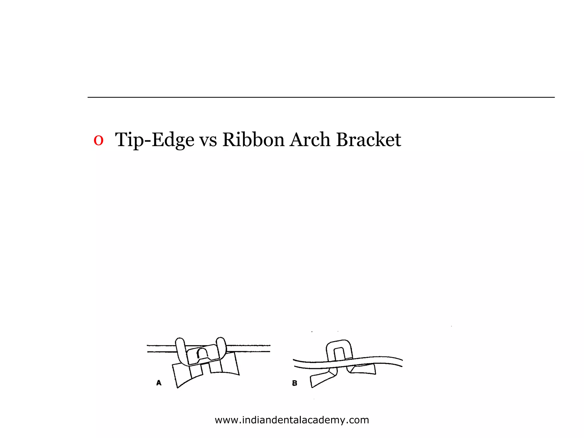 o Tip-Edge vs Ribbon Arch Bracket

www.indiandentalacademy.com

 