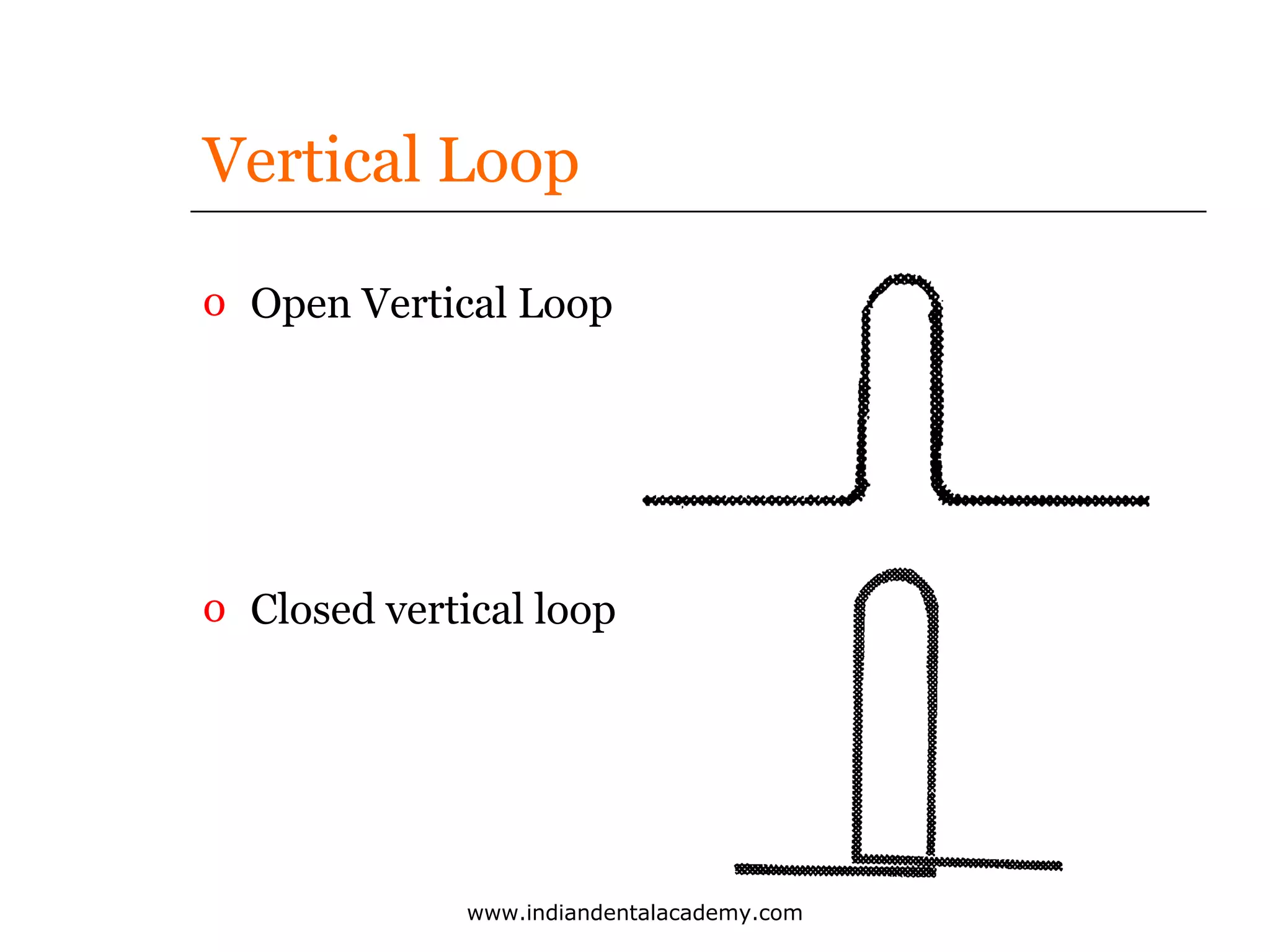 Vertical Loop
o Open Vertical Loop

o Closed vertical loop

www.indiandentalacademy.com

 