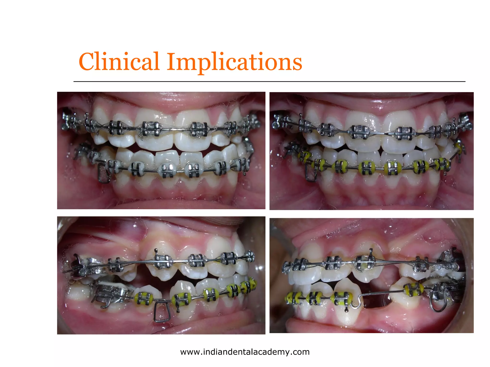 Clinical Implications

www.indiandentalacademy.com

 