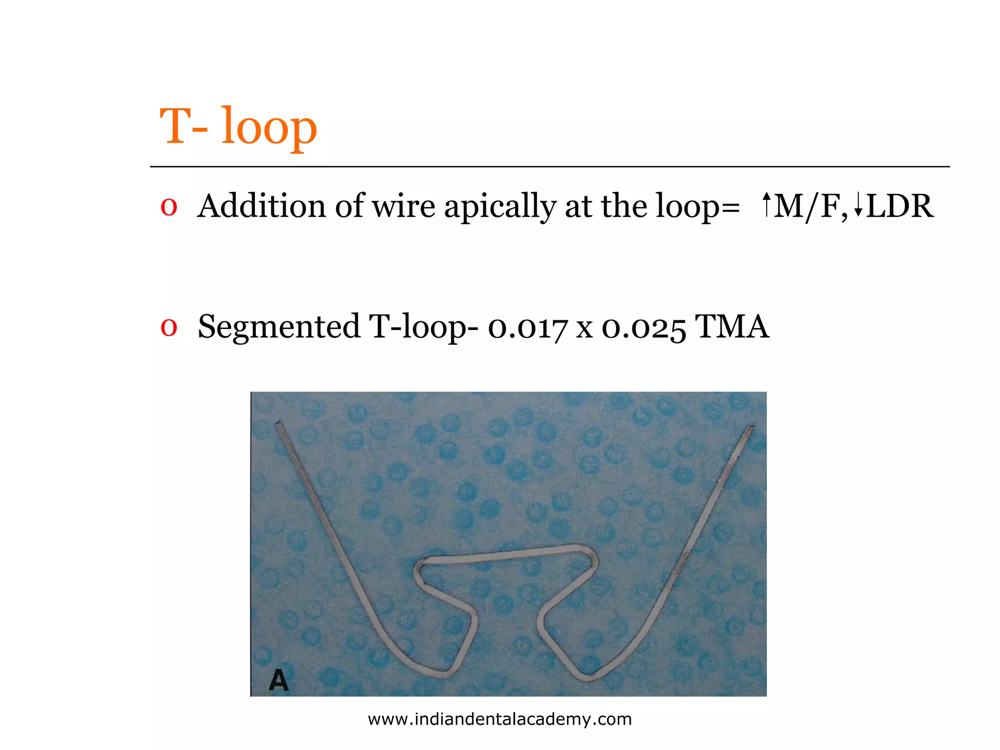 T- loop
o Addition of wire apically at the loop= M/F, LDR
o Segmented T-loop- 0.017 x 0.025 TMA

www.indiandentalacademy.com

 