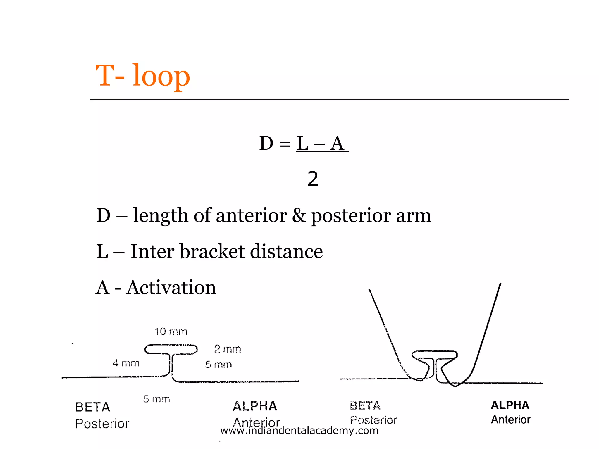 T- loop
D=L–A
2
D – length of anterior & posterior arm
L – Inter bracket distance
A - Activation

www.indiandentalacademy.com

 