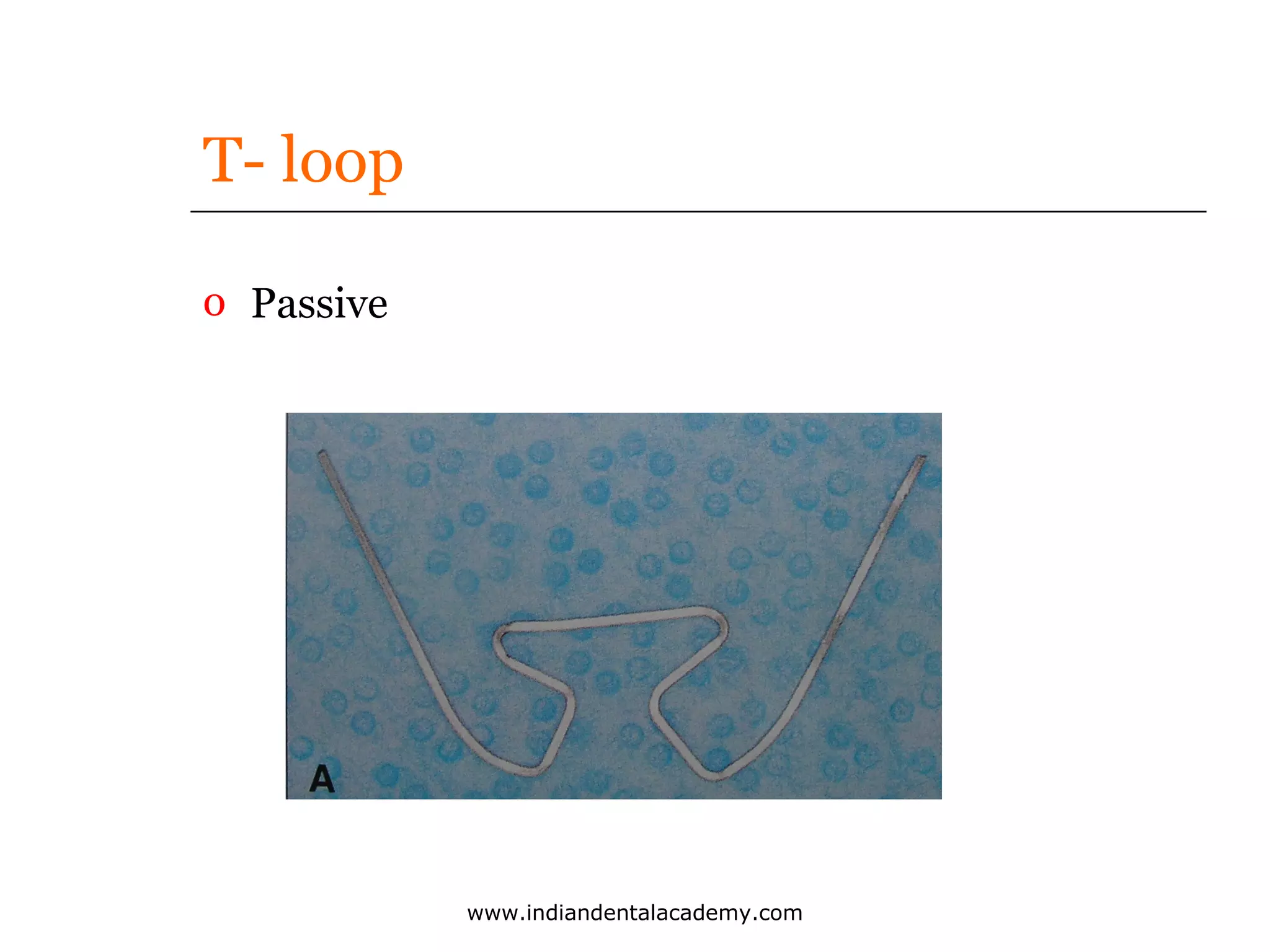 T- loop
o Passive

www.indiandentalacademy.com

 