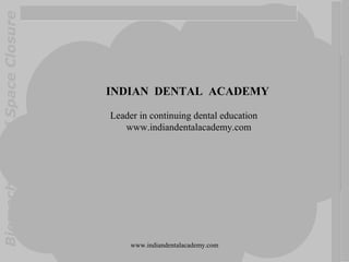 BiomechanicsofSpaceClosure
INDIAN DENTAL ACADEMY
Leader in continuing dental education
www.indiandentalacademy.com
www.indiandentalacademy.com
 