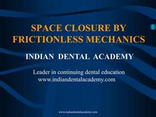 SPACE CLOSURE BY
FRICTIONLESS MECHANICS
INDIAN DENTAL ACADEMY
Leader in continuing dental education
www.indiandentalacademy.com

www.indiandentalacademy.com

 
