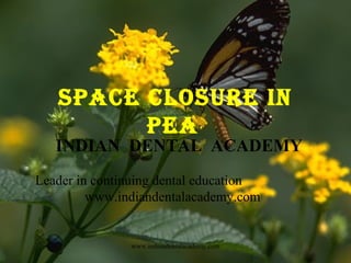 SPACE CLOSURE IN
PEA

INDIAN DENTAL ACADEMY
Leader in continuing dental education
www.indiandentalacademy.com

www.indiandentalacademy.com

 