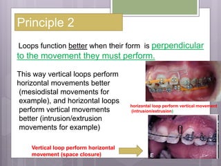 Principle 2
Loops function better when their form is perpendicular
to the movement they must perform.
This way vertical loops perform
horizontal movements better
(mesiodistal movements for
example), and horizontal loops
perform vertical movements
better (intrusion/extrusion
movements for example)
horizontal loop perform vertical movement
(intrusion/extrusion)
Vertical loop perform horizontal
movement (space closure)
 