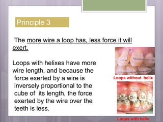 Principle 3
The more wire a loop has, less force it will
exert.
Loops with helixes have more
wire length, and because the
force exerted by a wire is
inversely proportional to the
cube of its length, the force
exerted by the wire over the
teeth is less.
Loops with helix
Loops without helix
 