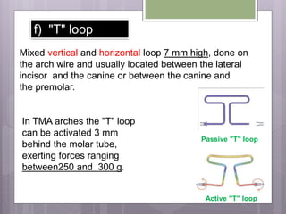 f) "T" loop
Mixed vertical and horizontal loop 7 mm high, done on
the arch wire and usually located between the lateral
incisor and the canine or between the canine and
the premolar.
In TMA arches the "T" loop
can be activated 3 mm
behind the molar tube,
exerting forces ranging
between250 and 300 g.
Passive "T" loop
Active "T" loop
 