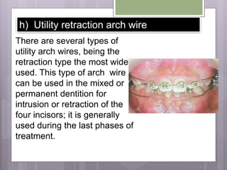 h) Utility retraction arch wire
There are several types of
utility arch wires, being the
retraction type the most widely
used. This type of arch wire
can be used in the mixed or
permanent dentition for
intrusion or retraction of the
four incisors; it is generally
used during the last phases of
treatment.
 