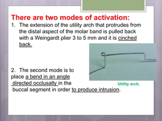 There are two modes of activation:
1. The extension of the utility arch that protrudes from
the distal aspect of the molar band is pulled back
with a Weingardt plier 3 to 5 mm and it is cinched
back.
2. The second mode is to
place a bend in an angle
directed occlusally in the
buccal segment in order to produce intrusion.
Utility arch.
 