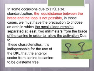 In some occasions due to DKL size
standardization, the equidistance between the
brace and the loop is not possible, in those
cases, we must have the precaution to choose
an arch in which the mesial loop remains
separated at least two millimeters from the brace
of the canine in order to allow the activation Due
to
these characteristics, it is
indispensable for the use of
the DKL that the anterior
sector from canine to canine
to be diastema free.
 