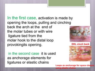 In the first case, activation is made by
opening the loops, pulling and cinching
back the arch at the end of
the molar tubes or with wire
ligature tied from the
molar hook to the distal loop
provokingits opening.
in the second case it is used
as anchorage elements for
ligatures or elastic chains
DKL cinch back
Loops as anchorage for space closure
using elastic chains
 