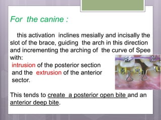 For the canine :
this activation inclines mesially and incisally the
slot of the brace, guiding the arch in this direction
and incrementing the arching of the curve of Spee
with:
intrusion of the posterior section
and the extrusion of the anterior
sector.
This tends to create a posterior open bite and an
anterior deep bite.
 