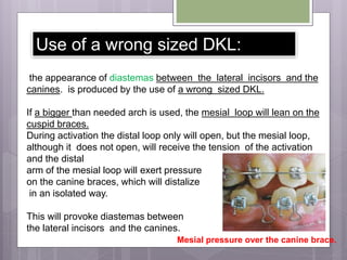 Use of a wrong sized DKL:
the appearance of diastemas between the lateral incisors and the
canines. is produced by the use of a wrong sized DKL.
If a bigger than needed arch is used, the mesial loop will lean on the
cuspid braces.
During activation the distal loop only will open, but the mesial loop,
although it does not open, will receive the tension of the activation
and the distal
arm of the mesial loop will exert pressure
on the canine braces, which will distalize
in an isolated way.
This will provoke diastemas between
the lateral incisors and the canines.
Mesial pressure over the canine brace.
 