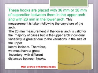 These hooks are placed with 36 mm or 38 mm
of separation between them in the upper arch
and with 26 mm in the lower arch. This
measurement is taken following the curvature of the
arch.
The 26 mm measurement in the lower arch is valid for
the majority of cases but in the upper arch individual
variability is greater due to the variations in the size of
the upper
lateral incisors. Therefore,
we must have a great
inventory with different
distances between hooks.
MBT arches with brass hooks
 