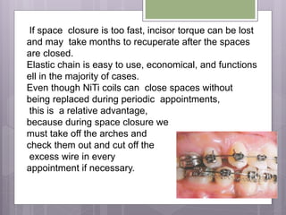 If space closure is too fast, incisor torque can be lost
and may take months to recuperate after the spaces
are closed.
Elastic chain is easy to use, economical, and functions
ell in the majority of cases.
Even though NiTi coils can close spaces without
being replaced during periodic appointments,
this is a relative advantage,
because during space closure we
must take off the arches and
check them out and cut off the
excess wire in every
appointment if necessary.
 