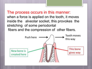 The process occurs in this manner:
when a force is applied on the tooth, it moves
inside the alveolar socket, this provokes the
stretching of some periodontal
fibers and the compression of other fibers.
 