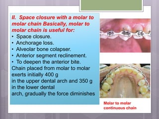 II. Space closure with a molar to
molar chain Basically, molar to
molar chain is useful for:
• Space closure.
• Anchorage loss.
• Alveolar bone colapser.
• Anterior segment reclinement.
• To deepen the anterior bite.
Chain placed from molar to molar
exerts initially 400 g
in the upper dental arch and 350 g
in the lower dental
arch, gradually the force diminishes
Molar to molar
continuous chain
 
